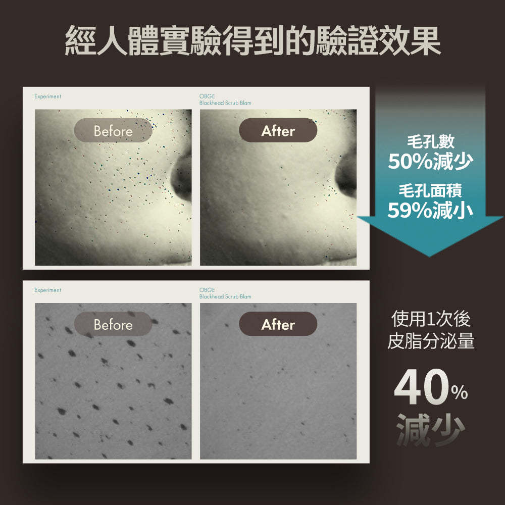 Blackhead Scrub Balm