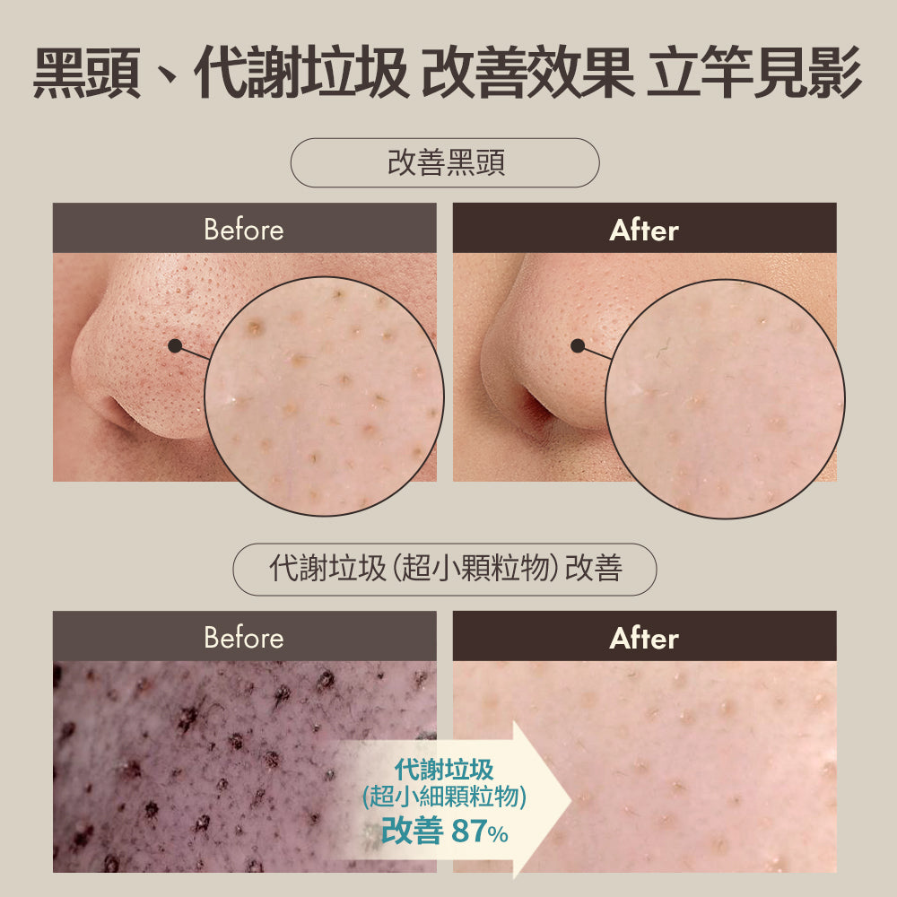 Blackhead Scrub Balm