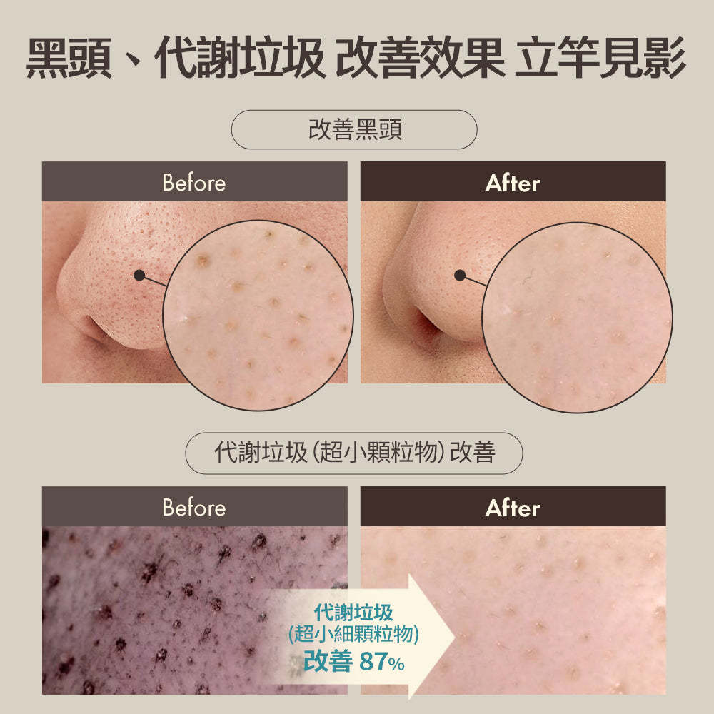 Blackhead Scrub Balm