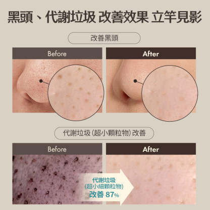 Blackhead Scrub Balm