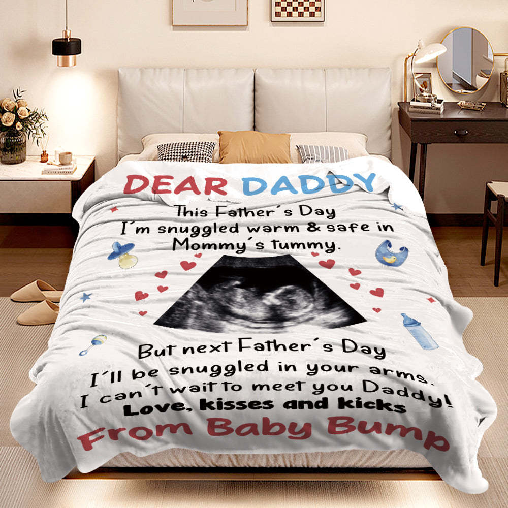 Custom Photo Blanket Personalized Ultrasound Blanket Gift for New Dad - auphotoblanket