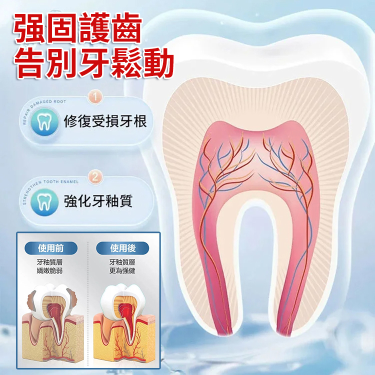 【改善牙齦腫痛、敏感、出血、牙齒鬆動問題】牙齒分離劑牙膏