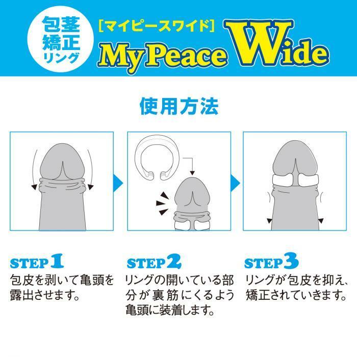 NPG My Peace Wide 男用包莖矯正環，C形開放式設計，舒適不壓迫尿道