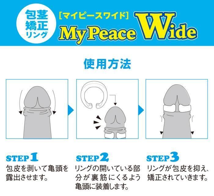 男用包莖矯正環 闊版｜提升矯正效果，佩戴舒適無異物感，免手術輕鬆改善包莖