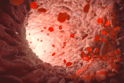 P_14.gif