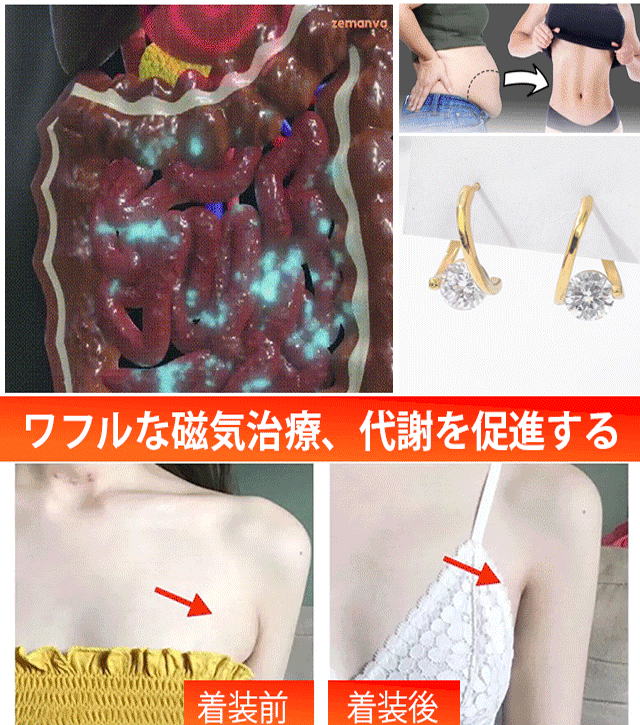 耳ツボ療法ピアス