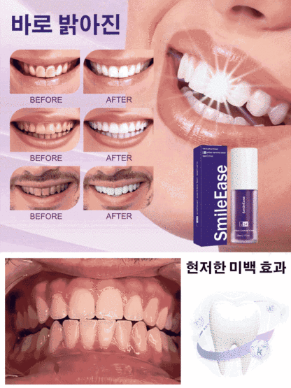 [치아 생얼크림] 화이트닝 치약