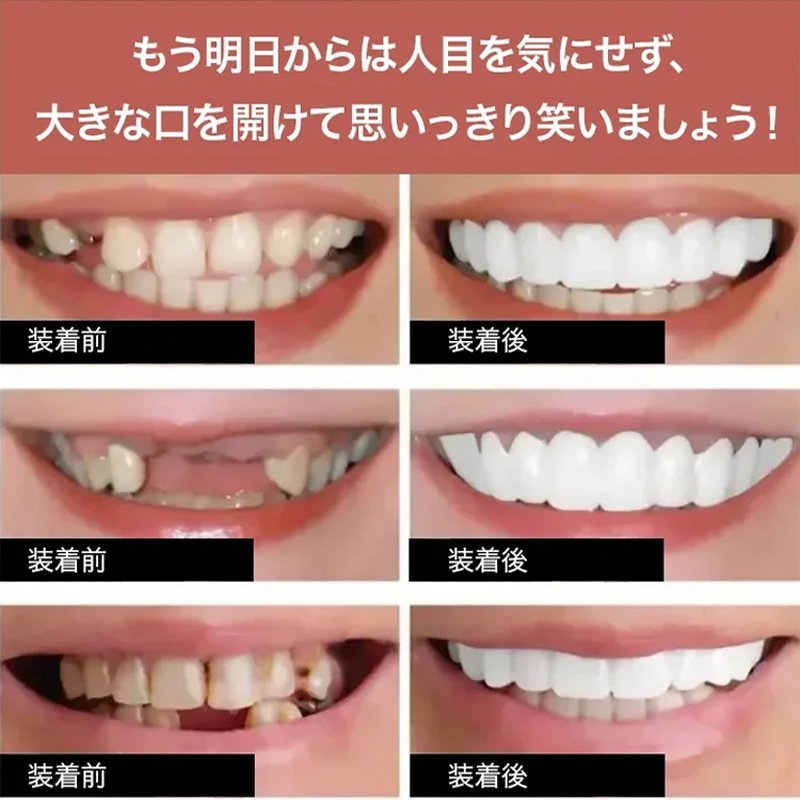調節可能なつけ歯