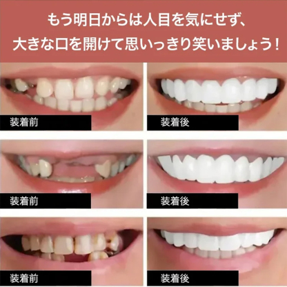 調節可能なつけ歯
