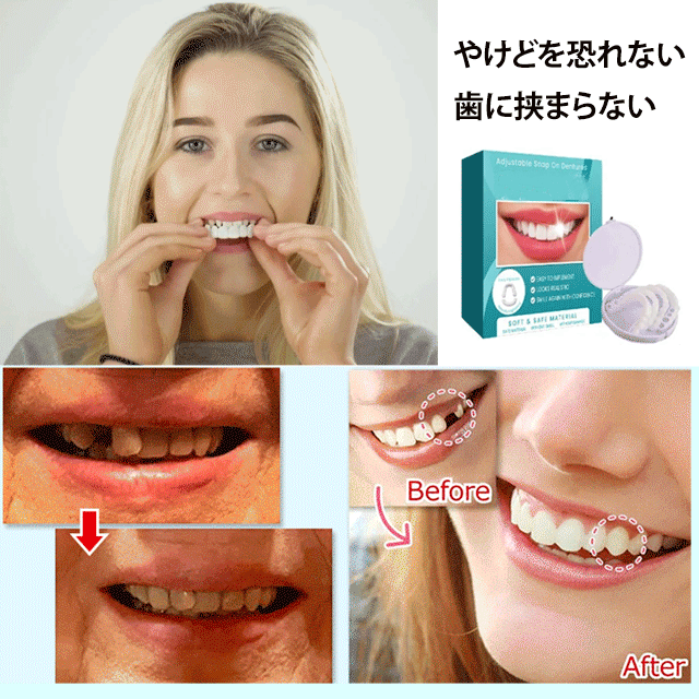 調節可能なつけ歯