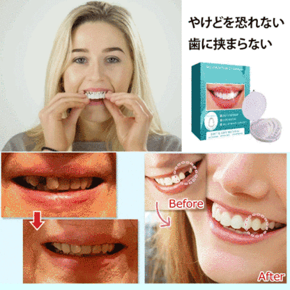 調節可能なつけ歯
