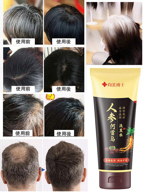 從根源轉黑人參何首烏洗髮水