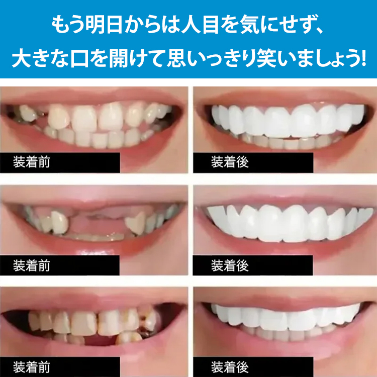 SorriBemシリコーン入れ歯